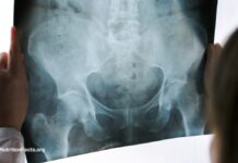 Ганебна практика проведення гінекологічних оглядів без згоди пацієнтів під наркозом