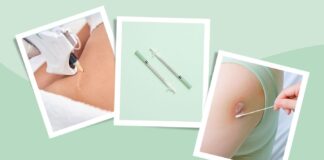 Revisão da cicatriz: opções, riscos e o que esperar