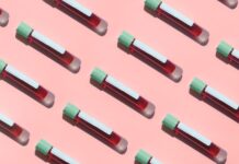 Понимание результатов анализов при IgAN: руководство по здоровью почек