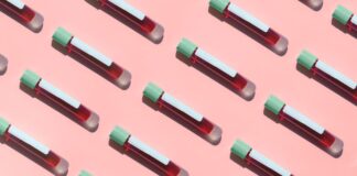 Понимание результатов анализов при IgAN: руководство по здоровью почек