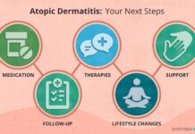 Розуміння Атопічного Дерматиту: Повне Посібник