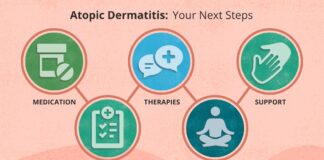 Zrozumienie atopowego zapalenia skóry: kompletny przewodnik